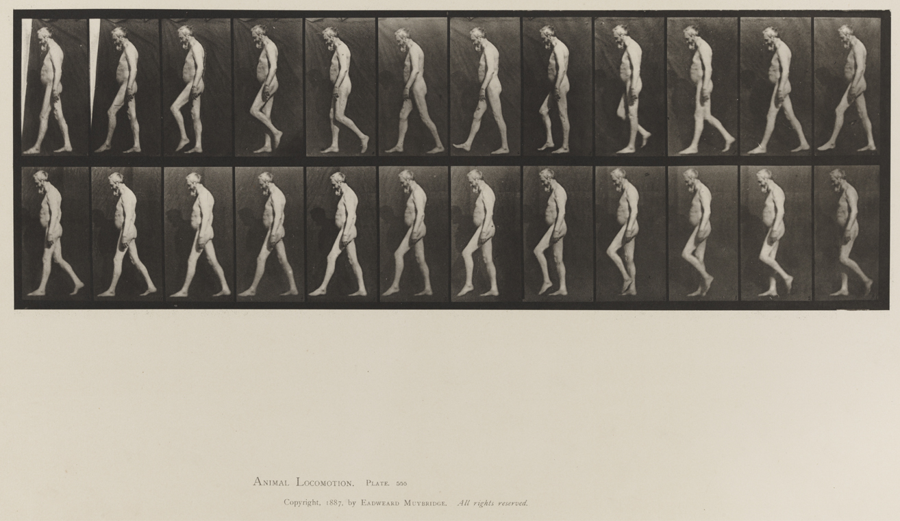 Animal Locomotion, Volume VIII, Abnormal Movements, Men and Women (Nude and Semi-Nude). Plate 555