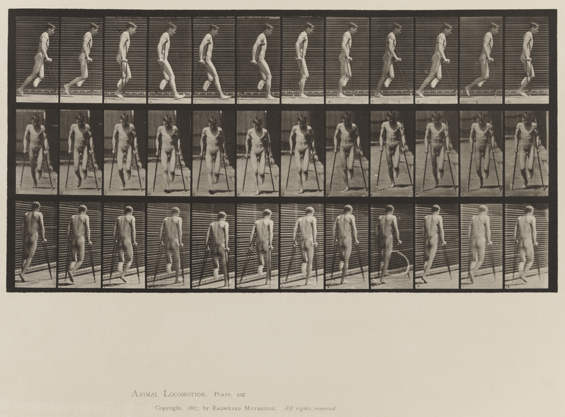 Animal Locomotion, Volume VIII, Abnormal Movements, Men and Women (Nude and Semi-Nude). Plate 537