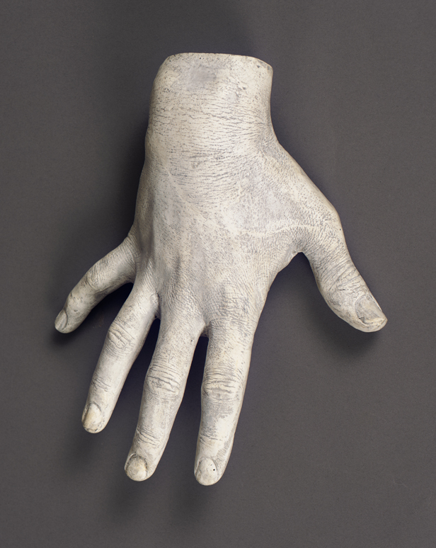 Life Cast of the Right Hand of Thomas Eakins