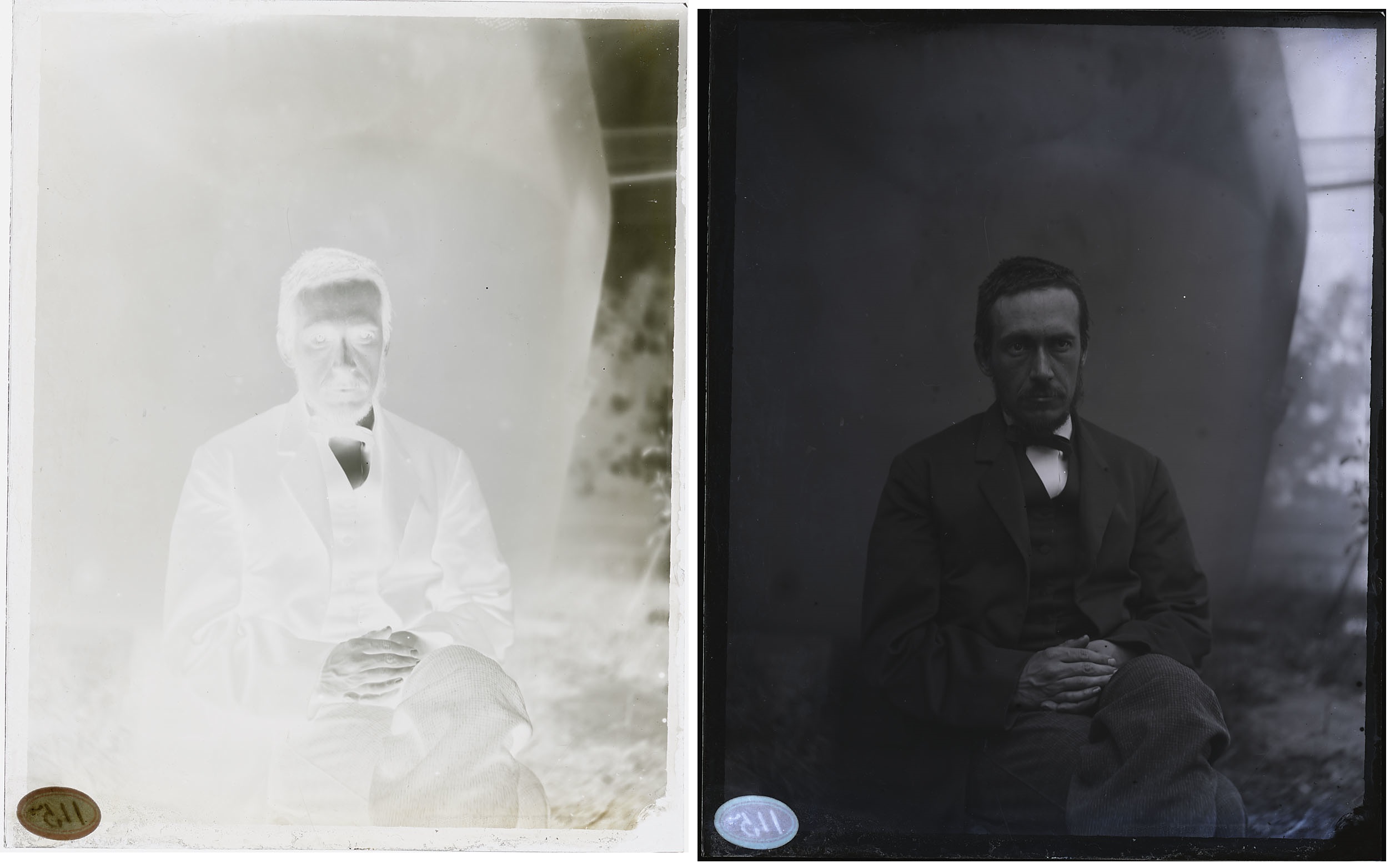 Thomas Eakins at age thirty-five to forty