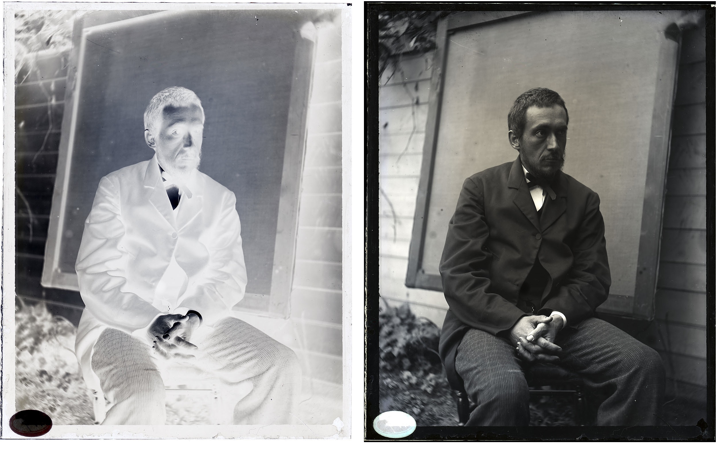Thomas Eakins at age thirty-five to forty