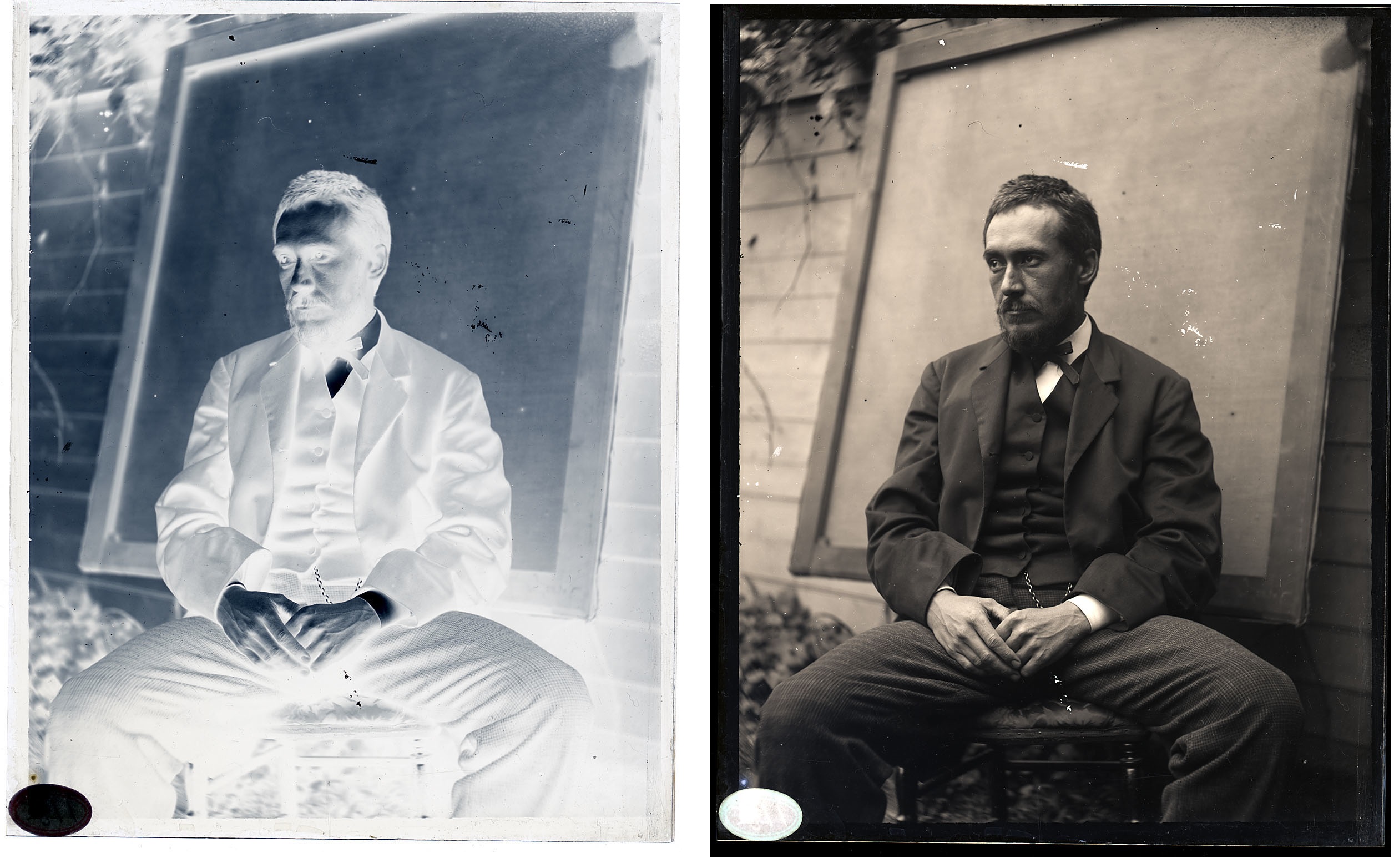 Thomas Eakins at age thirty-five to forty
