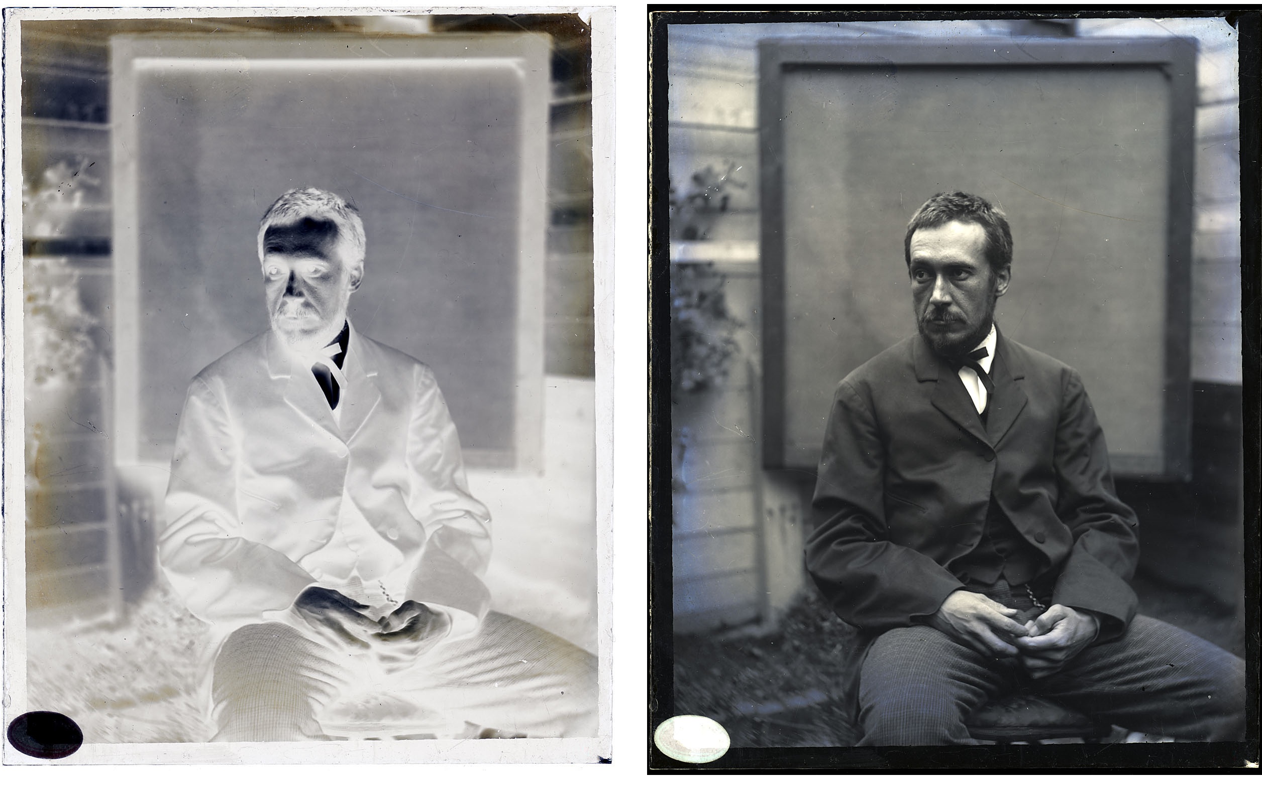 Thomas Eakins at age thirty-five to forty