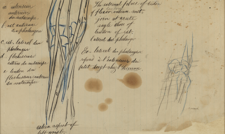 Dissection Study: Human (Tendons Crossing the Joint of the Little Finger, Left Arm)