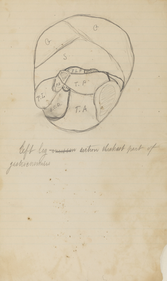Dissection Study: Human (Cross-section of Lower Left Leg at thickest part of Gastrocnemius)