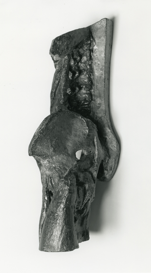 Left Half of Vertebral Column, Pelvis, and Upper Half of Thigh