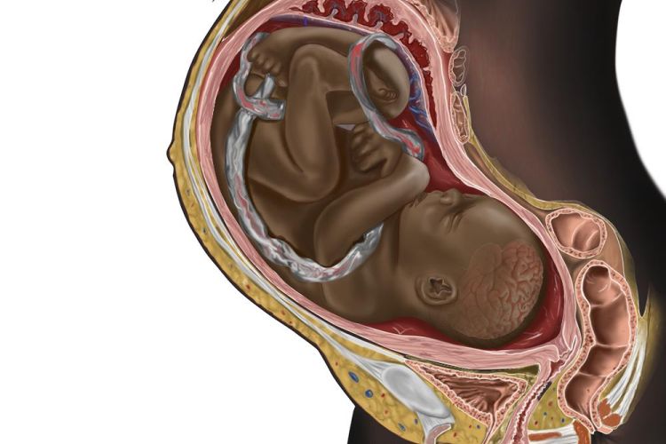 Medical illustration of Black pregnant person and Black fetus